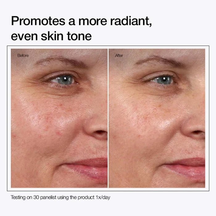 URAPRA Glycolic Acid 7% Toning Solution Buy 1 Get 1 Free