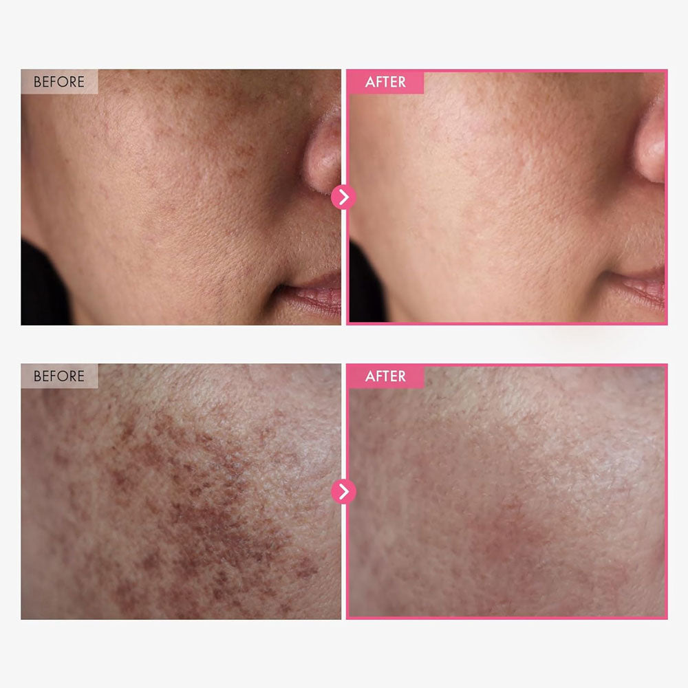 TOSOWOONG Arbutin 5% Whitening Cream 50ml