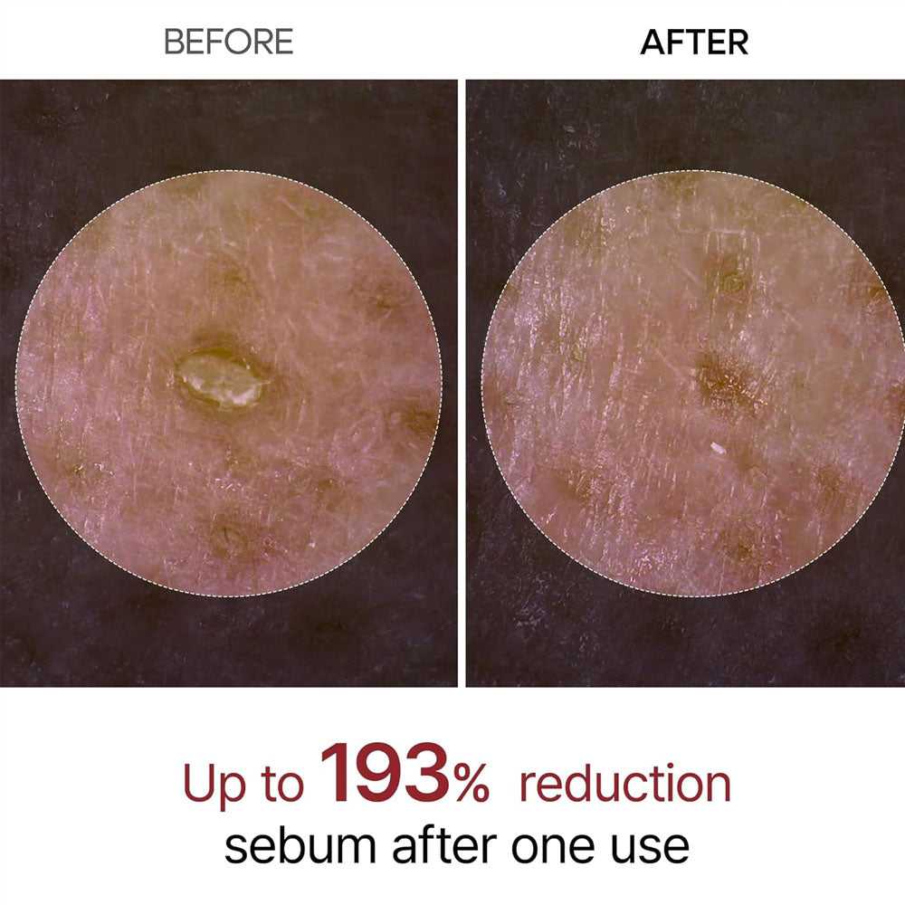 Dr.Melaxin Peel Shot Exfoliant White Rice Ampoule 80ml