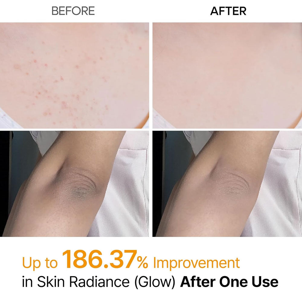 Dr.Melaxin Peel Shot Exfoliating Kojic Acid Turmeric Spray 200ml
