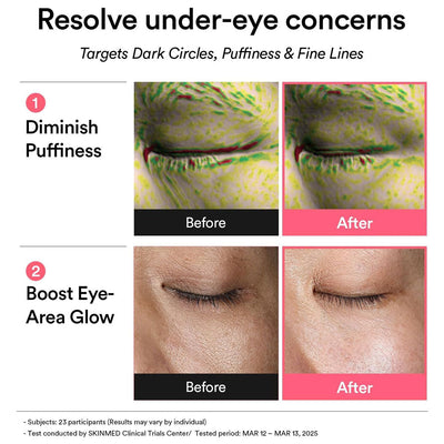Abib PDRN Retinal Eye Patch Glow Jelly 60 patches