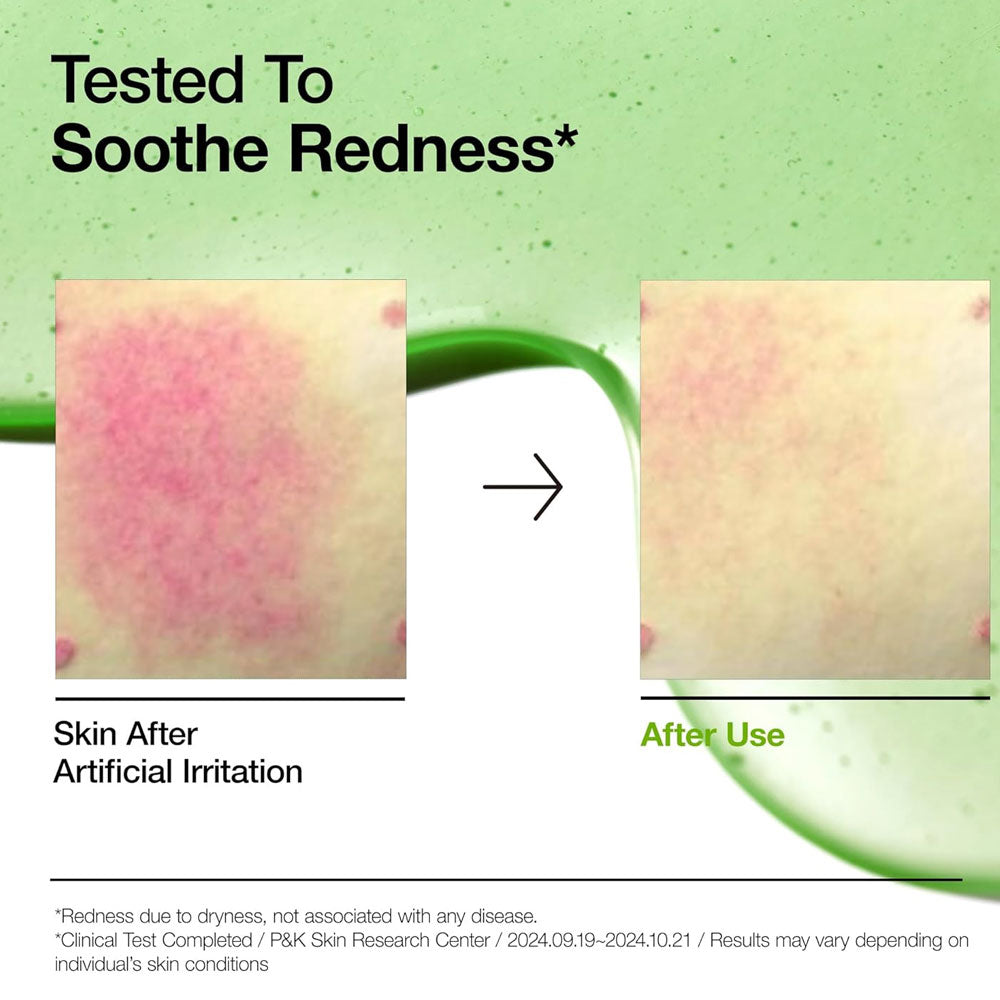 Anua Azelaic Acid 10 Hyaluron Redness Soothing Serum