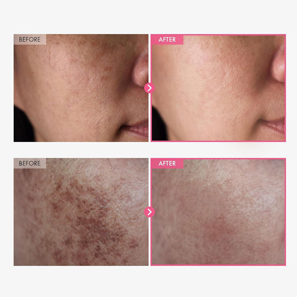 TOSOWOONG Arbutin 7% + Tranexamic Acid 4% Cream 50ml