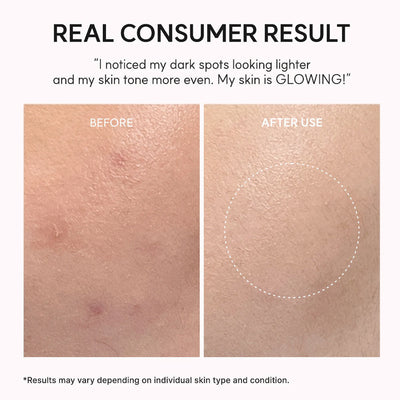 celimax Pore+ Dark Spot Brightening Care Sunscreen 50ml