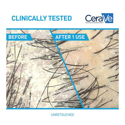 CeraVe Anti-Dandruff Hydrating Conditioner 266ml