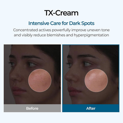 Dr.Melaxin TX Cream 50ml