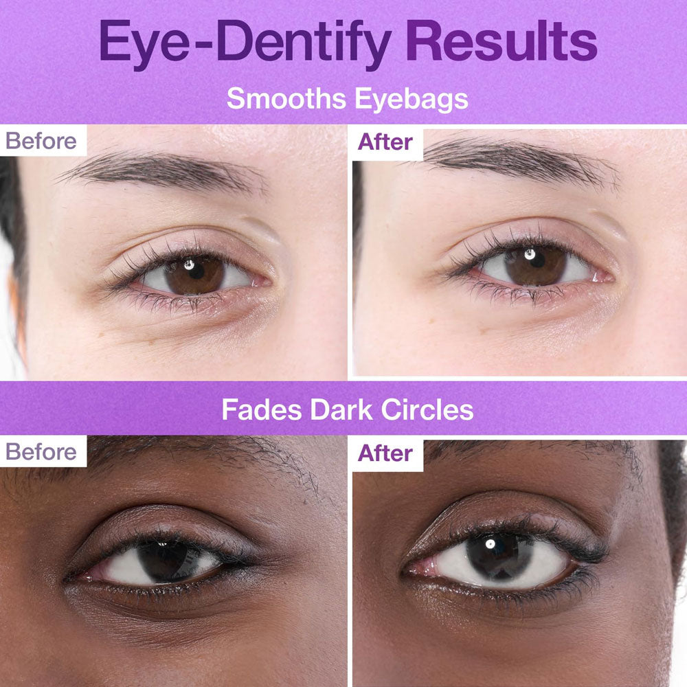 Numbuzin No.9 NAD+ Collagen Under Eye Patches 8g x 5 pairs
