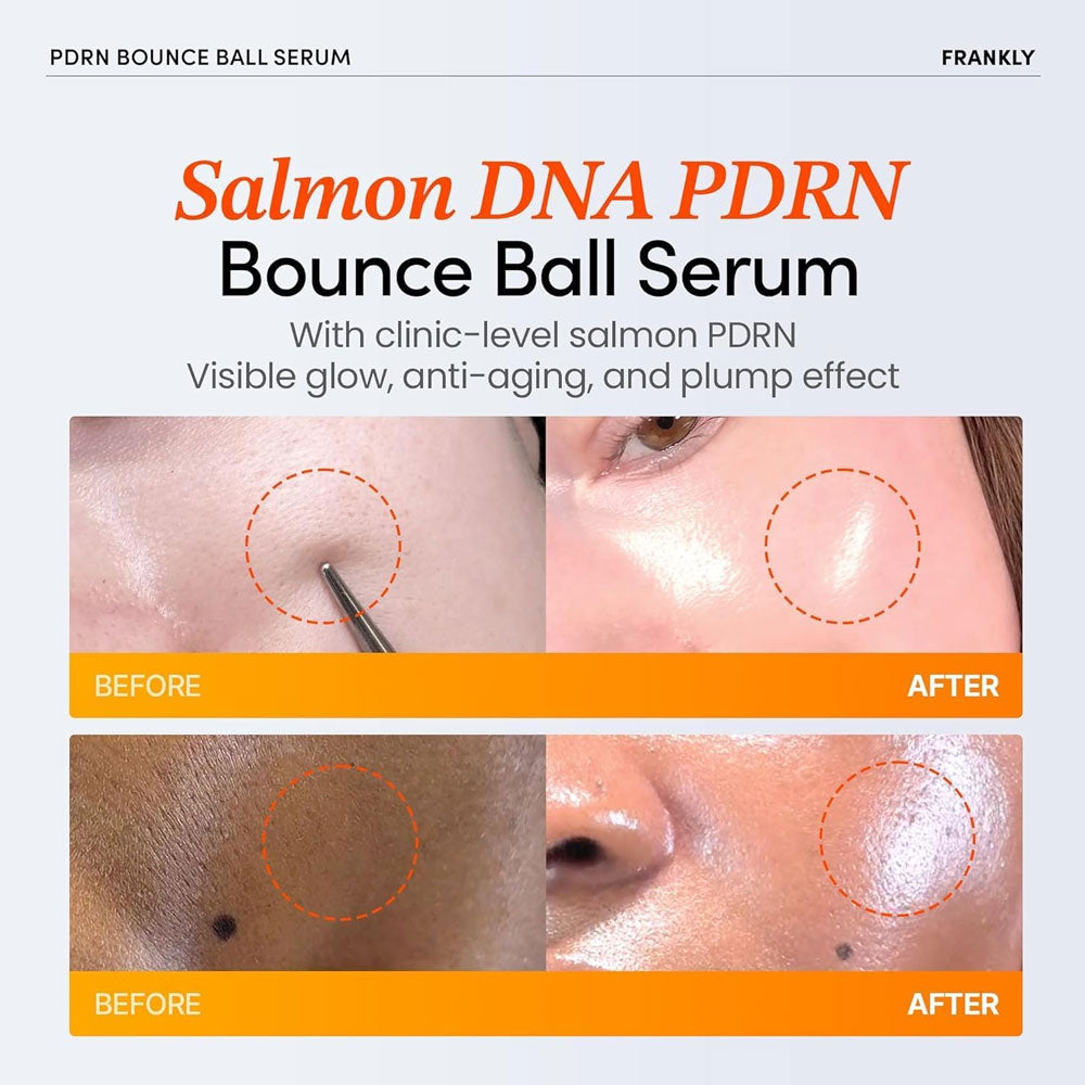 FRANKLY PDRN Bounce Ball Serum 30ml