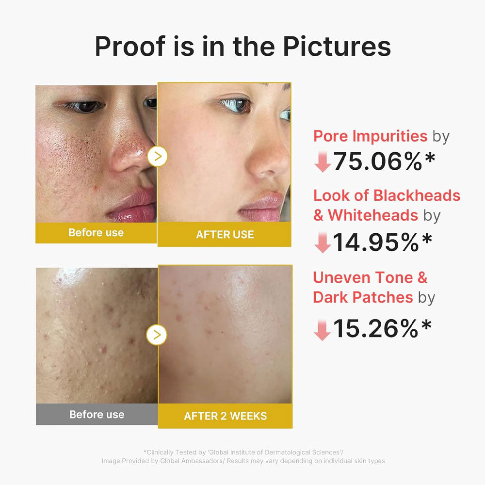 Medicube Kojic Acid Turmeric Peel Shot 80ml