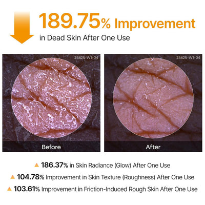 Dr.Melaxin Peel Shot Exfoliating Kojic Acid Turmeric Spray 200ml