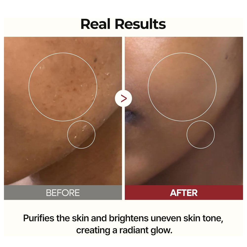 Dr.Melaxin Peel Shot Glow White Rice Toner 200ml