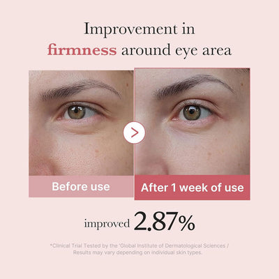Medicube PDRN Pink Peptide Eye Cream 30ml