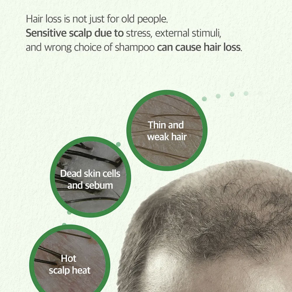 SOME BY MI Cica Peptide Anti Hair Loss Derma Scalp Tonic 150ml
