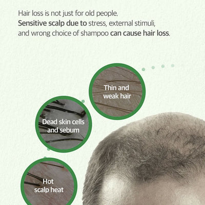 SOME BY MI Cica Peptide Anti Hair Loss Derma Scalp Tonic 150ml
