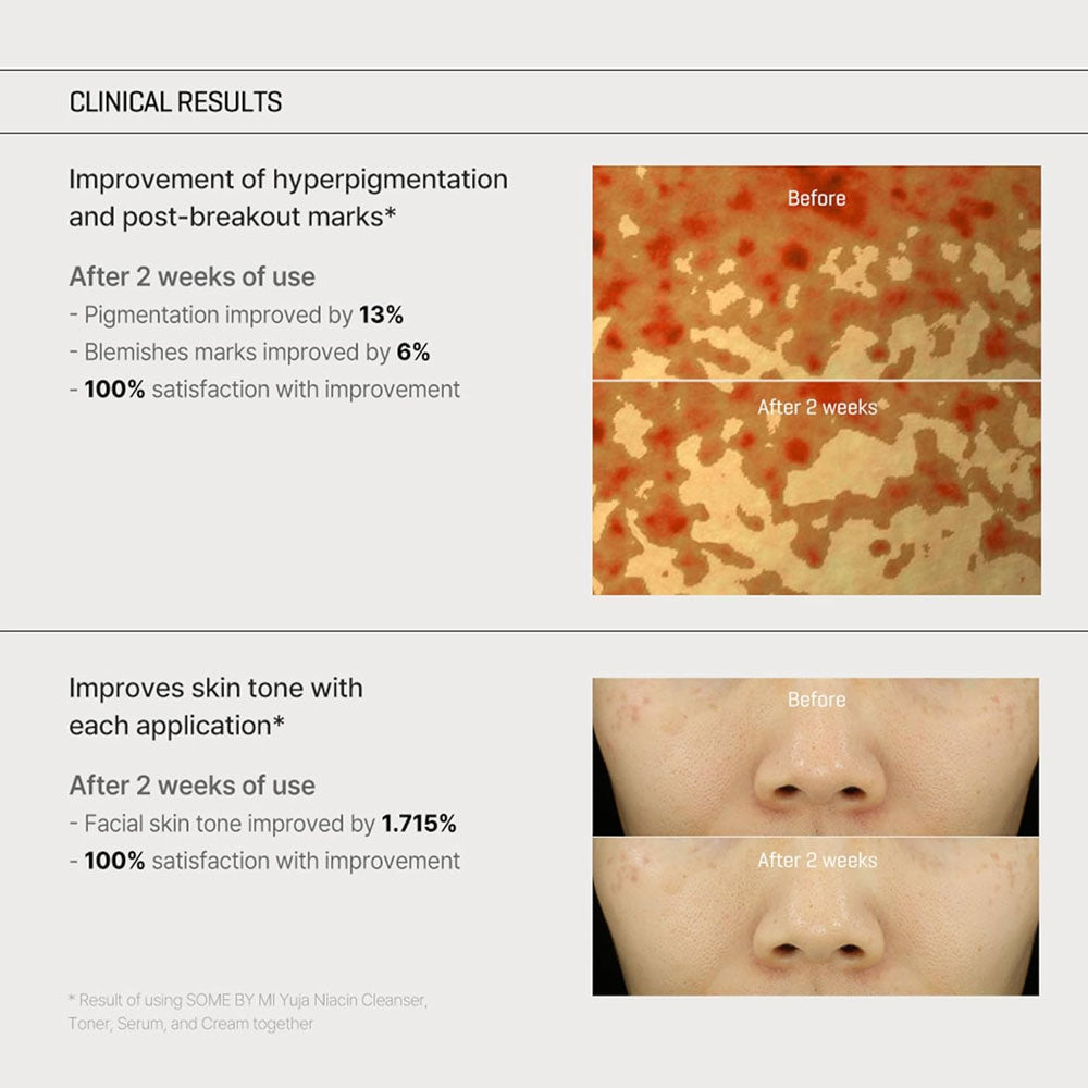 SOME BY MI Yuja Niacin Anti Blemish Cream 60g
